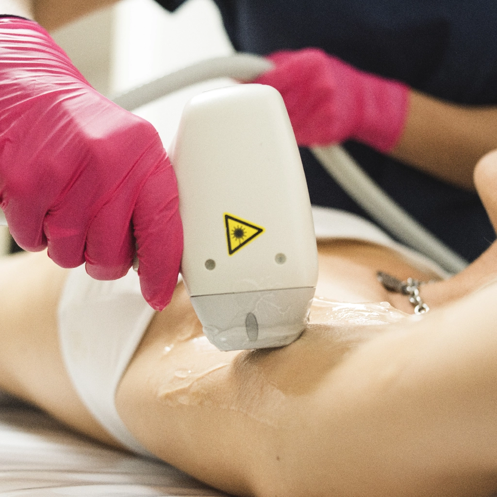 Bella_Vita_Depilacion_Definitiva_13