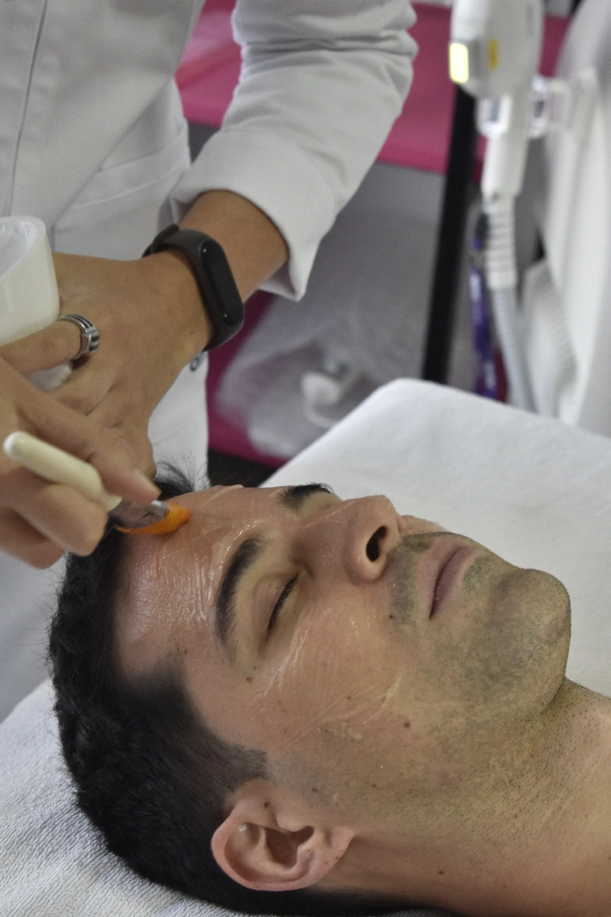 Bella_Vita_Luz_Pulsada_10