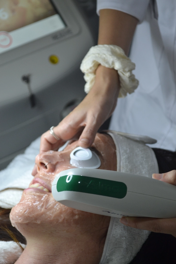 Bella_Vita_Luz_Pulsada_13