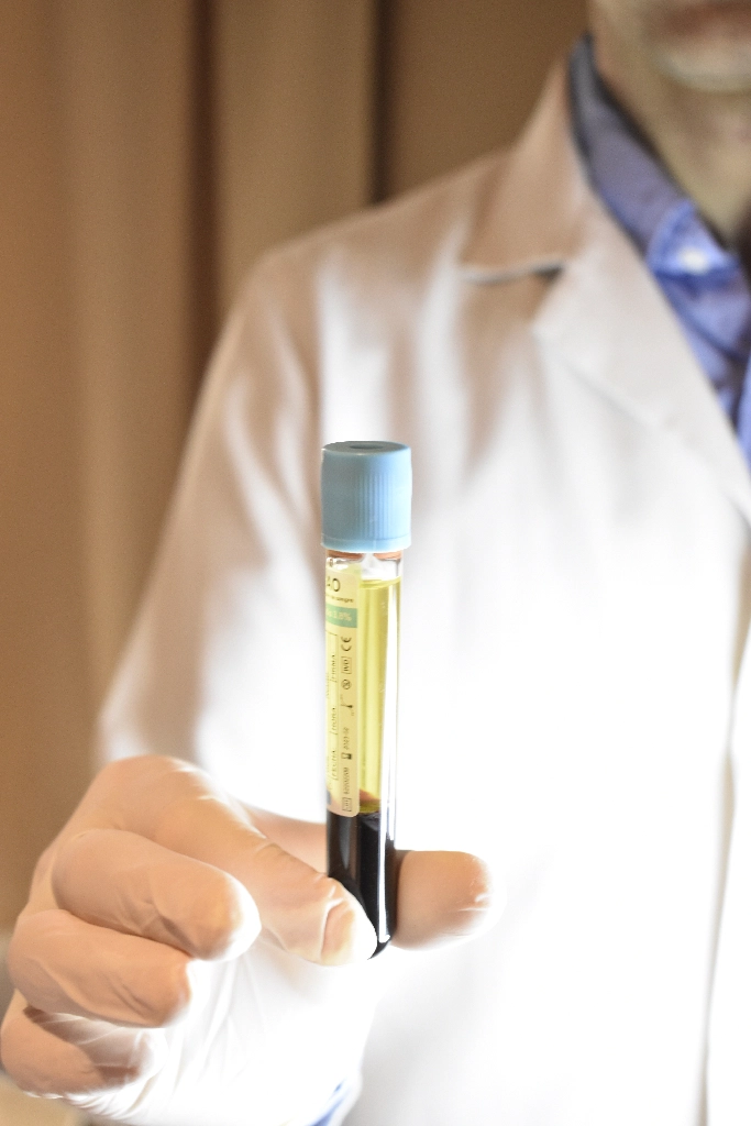 plasma_rico_plaquetas_13