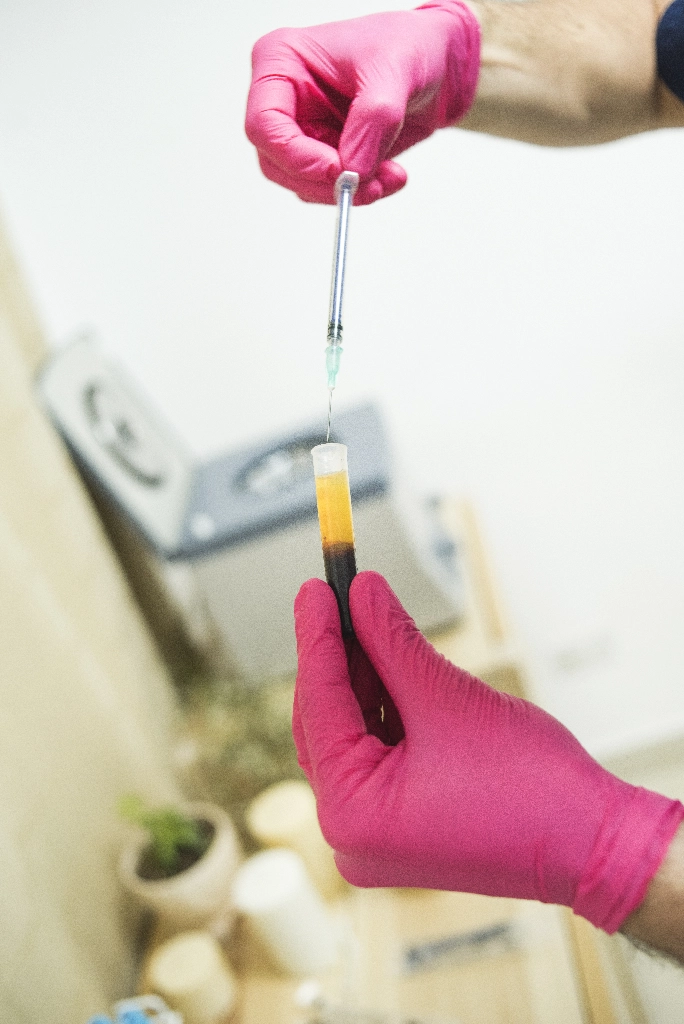 plasma_rico_plaquetas_9